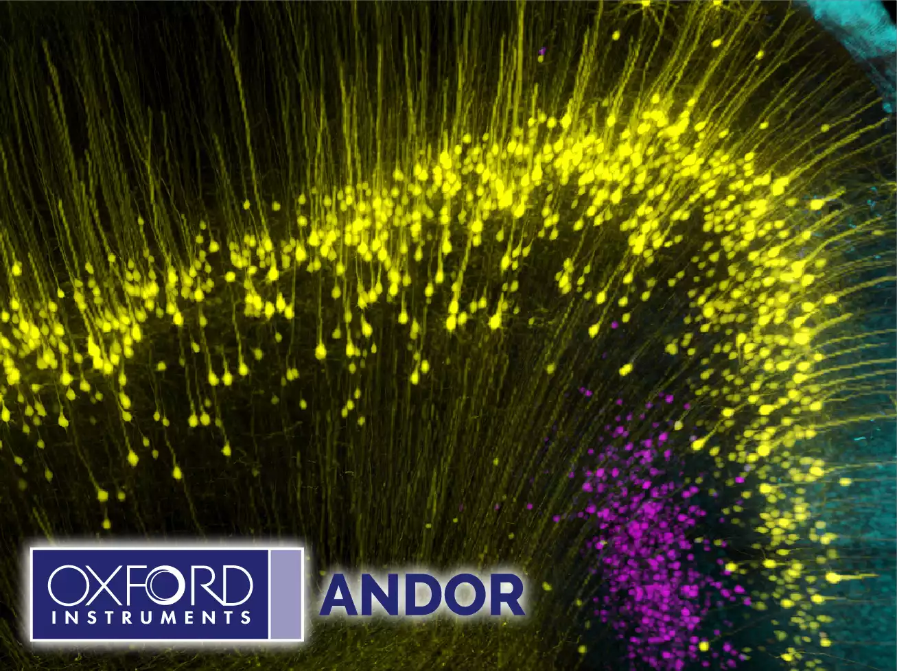 Andor High-Speed Confocal with 3D Super-Resolution